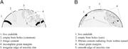 Third thumbnail for: Microboring Versus Recrystallization: Further Insi...