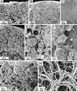 Third thumbnail for: Recent Freshwater Ooids and Oncoids from Western L...
