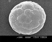 Third thumbnail for: Microbial Biscuits of Vaterite in Lake Issyk-Kul (...