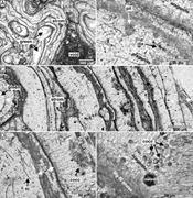Second thumbnail for: Microbialite Formation in Seawater of Increased Al...