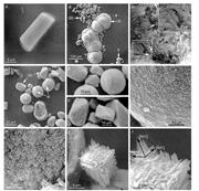 Second thumbnail for: Precipitation and Growth Morphology of Calcium Car...