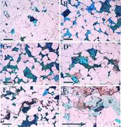 Third thumbnail for: Kaolin-Coating of Stylolites, Effect on Quartz Cem...