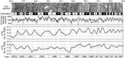 Third thumbnail for: Climatic Conditions and Hydrological Change Record...
