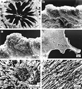Second thumbnail for: Earliest Steps of Diagenesis in Living Scleractini...