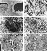 Third thumbnail for: Earliest Steps of Diagenesis in Living Scleractini...