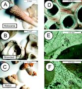Third thumbnail for: Early Diagenesis of Carbonates on a Cool-Water Car...