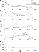 Second thumbnail for: The Critical Densimetric Froude Number of Subaqueo...