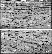 Third thumbnail for: Stratigraphic Architecture of An Experimental Basi...