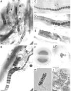 Third thumbnail for: Gene Sequencing-Based Analysis of Microbial-Mat Mo...