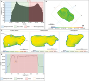 First thumbnail for: Quantification of the morphology of gold grains in...