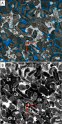 Second thumbnail for: Microporosity quantification using confocal micros...