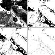 Third thumbnail for: Microporosity quantification using confocal micros...