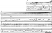 Second thumbnail for: Coastal switching of dominant depositional process...